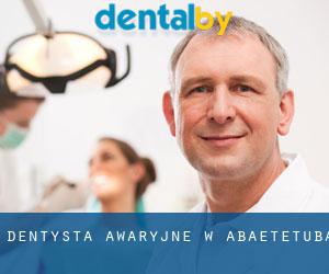Dentysta awaryjne w Abaetetuba