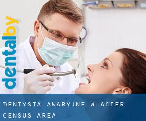 Dentysta awaryjne w Acier (census area)