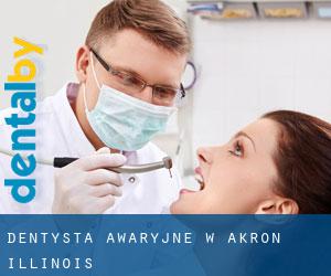 Dentysta awaryjne w Akron (Illinois)