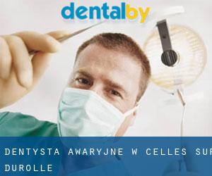 Dentysta awaryjne w Celles-sur-Durolle