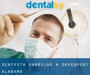 Dentysta awaryjne w Davenport (Alabama)
