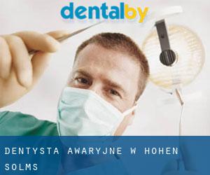 Dentysta awaryjne w Hohen Solms