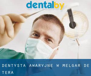 Dentysta awaryjne w Melgar de Tera