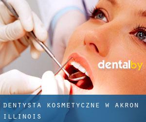 Dentysta kosmetyczne w Akron (Illinois)