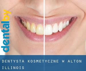 Dentysta kosmetyczne w Alton (Illinois)