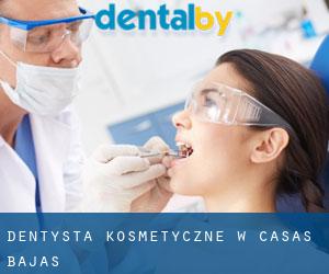 Dentysta kosmetyczne w Casas Bajas