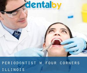 Periodontist w Four Corners (Illinois)