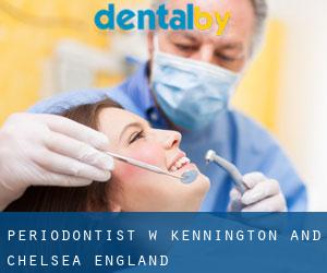 Periodontist w Kennington and Chelsea (England)