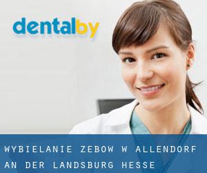 Wybielanie zębów w Allendorf an der Landsburg (Hesse)