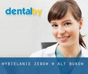 Wybielanie zębów w Alt Bukow