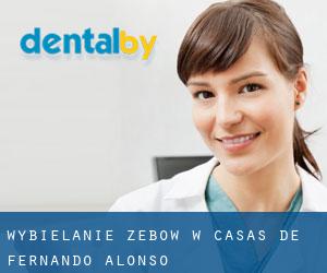 Wybielanie zębów w Casas de Fernando Alonso