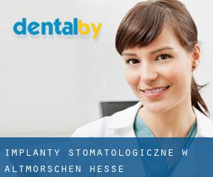 Implanty stomatologiczne w Altmorschen (Hesse)