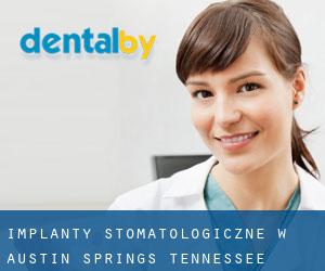 Implanty stomatologiczne w Austin Springs (Tennessee)