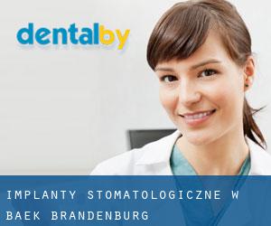 Implanty stomatologiczne w Baek (Brandenburg)