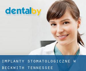 Implanty stomatologiczne w Beckwith (Tennessee)