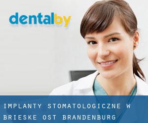 Implanty stomatologiczne w Brieske Ost (Brandenburg)
