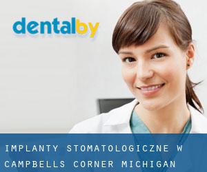 Implanty stomatologiczne w Campbells Corner (Michigan)