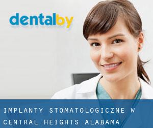 Implanty stomatologiczne w Central Heights (Alabama)
