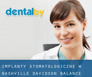 Implanty stomatologiczne w Nashville-Davidson (balance)